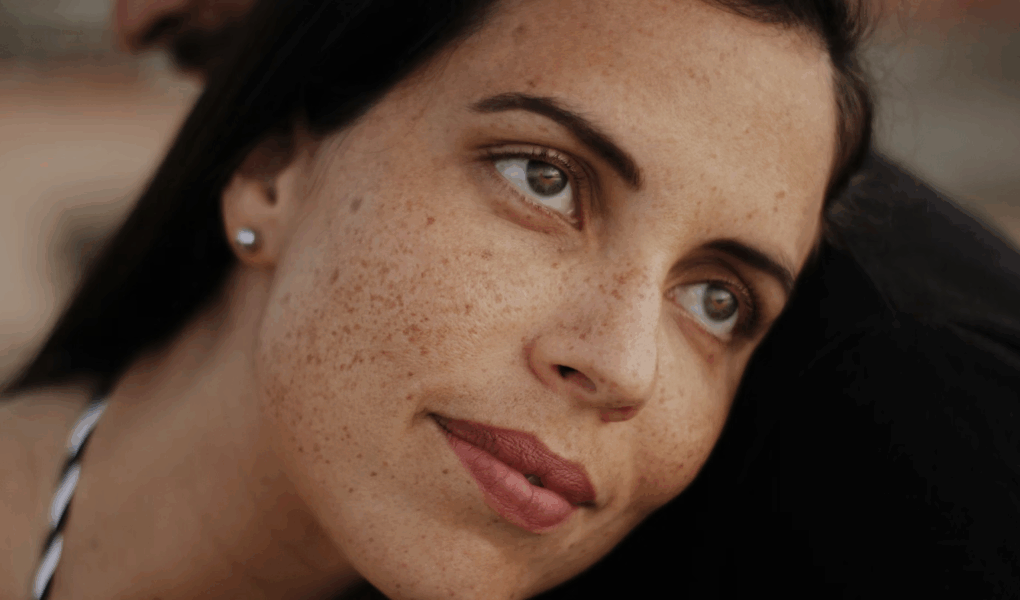 Atténuer les taches brunes : les sérums les plus efficaces contre les imperfections de la peau