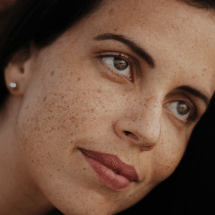 Atténuer les taches brunes : les sérums les plus efficaces contre les imperfections de la peau