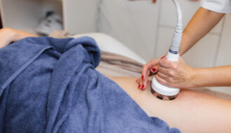 La cryolipolyse fonctionne-t-elle ? Je vous explique comment le froid élimine les graisses tenaces pour sculpter votre corps sans chirurgie.