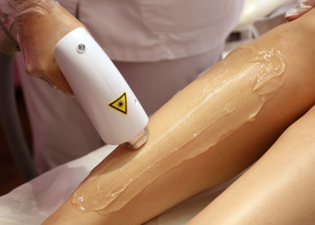 Application d'épilation laser professionnelle sur les jambes chez Lucie Concept Beauté à Caudry, avec gel conducteur.